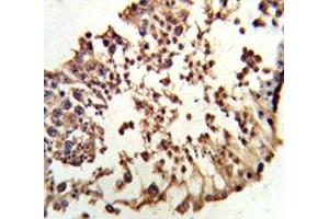 IHC analysis of FFPE human testis tissue stained with Retinoblastoma antibody (Retinoblastoma Protein (Rb) Antikörper  (AA 858-886))