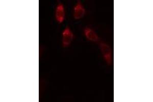 ABIN6272464 staining Hela by IF/ICC. (WDHD1 Antikörper  (Internal Region))