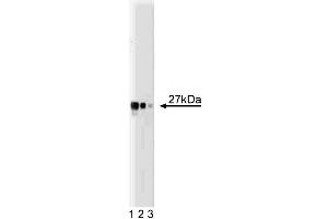 Western blot analysis of Drp1 on a HCT-8 cell lysate (Human colorectal adenocarcinoma, ATCC CCL-244). (Density Regulated Protein Antikörper  (AA 19-201))