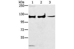 Western Blot analysis of Human fetal muscle tissue, A172 and K562 cell using ERK 5 Polyclonal Antibody at dilution of 1:250 (MAPK7 Antikörper)