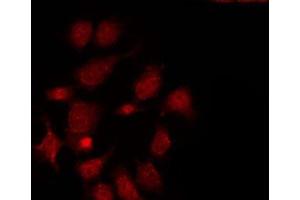 ABIN6275490 staining LOVO by IF/ICC. (ARHGAP17 Antikörper  (Internal Region))
