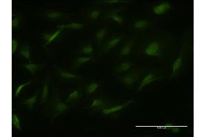 Immunofluorescence of monoclonal antibody to RALGPS2 on HeLa cell. (RALGPS2 Antikörper  (AA 282-386))