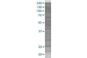 CDKN1B transfected lysate. (CDKN1B 293T Cell Transient Overexpression Lysate(Denatured))