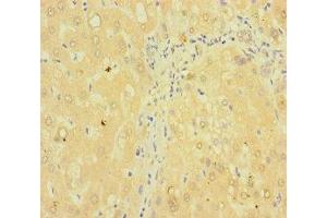 Immunohistochemistry of paraffin-embedded human liver tissue using ABIN7173003 at dilution of 1:100 (TMPRSS11B Antikörper  (AA 201-416))
