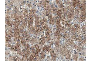 Image no. 3 for anti-Aldolase B, Fructose-Bisphosphate (ALDOB) antibody (ABIN1496605) (ALDOB Antikörper)