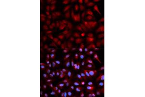 Immunofluorescence (IF) image for anti-Proteasome (Prosome, Macropain) Subunit, beta Type, 5 (PSMB5) antibody (ABIN1874372)