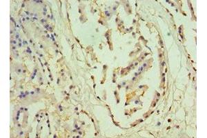 Immunohistochemistry of paraffin-embedded human prostate tissue using ABIN7155843 at dilution of 1:100 (OTX2 Antikörper  (AA 140-280))