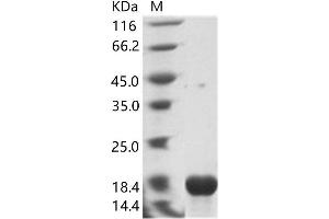 Sudan Ebola Virus Nucleoprotein (SEBOV NP) protein (His tag)