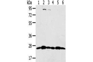 Gel: 8 % SDS-PAGE,Lysate: 40 μg,Lane 1-6: Hela cells, Raji cells, Jurkat cells, Human placenta tissue, A431 cells, 231 cells,Primary antibody: ABIN7192036(PSMB8 Antibody) at dilution 1/350 dilution,Secondary antibody: Goat anti rabbit IgG at 1/8000 dilution,Exposure time: 10 seconds (PSMB8 Antikörper)