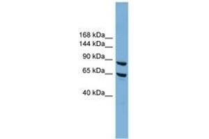 EXOC6 Antikörper  (N-Term)