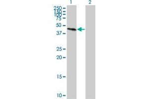 Western Blot analysis of GALT expression in transfected 293T cell line by GALT monoclonal antibody (M01), clone 4C11.
