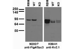 anti-FIG4 Homolog, SAC1 Lipid Phosphatase Domain Containing (FIG4) (AA 688-907) antibody