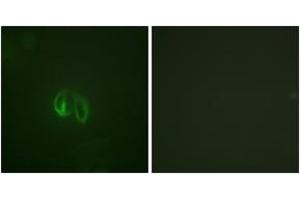 Immunofluorescence analysis of HepG2 cells, using IL-10R alpha (Ab-496) Antibody. (IL-10RA Antikörper  (AA 462-511))