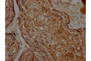 IHC image of ABIN7127862 diluted at 1:100 and staining in paraffin-embedded human placenta tissue performed on a Leica BondTM system. (Rekombinanter TNFRSF12A Antikörper)