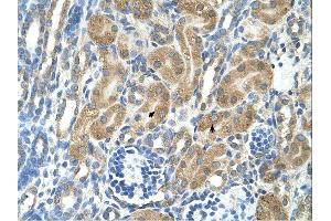 PARL antibody was used for immunohistochemistry at a concentration of 4-8 ug/ml.
