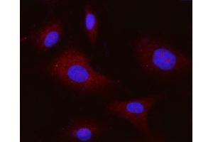 IF analysis of ITGAV using anti-ITGAV antibody (ABIN7602396).