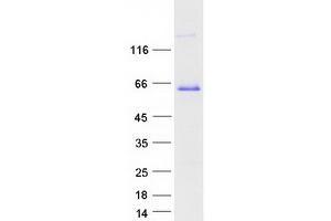 Validation with Western Blot