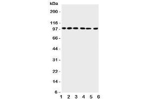Western blot testing of PIAS1 antibody and Lane 1:  rat testis