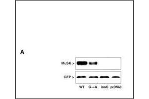 MuSK protein expression in extracts of COS cells after transfection with MuSK mutated and GFP constructs. (MUSK Antikörper  (N-Term))