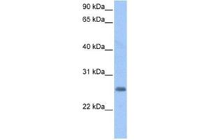 LOC730950 antibody used at 0. (LOC728743 Antikörper  (C-Term))