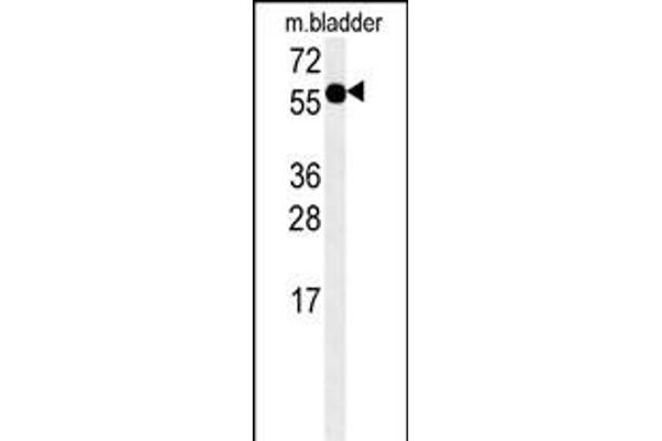 ADSSL1 Antikörper  (N-Term)