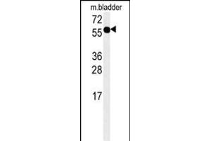 ADSSL1 Antibody (N-term) (ABIN652054 and ABIN2840523) western blot analysis in mouse bladder tissue lysates (15 μg/lane).