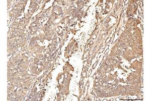 IHC analysis of BHMT using anti-BHMT antibody (ABIN7599940). (BHMT Antikörper  (AA 13-386))