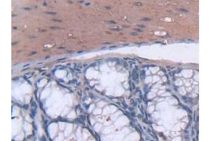 Immunohistochemistry (IHC) image for anti-Tsukushin (TSKU) (AA 30-307) antibody (ABIN7443770)