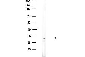 anti-Sulfotransferase Family 4A, Member 1 (SULT4A1) (C-Term) antibody