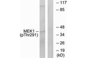 Western Blotting (WB) image for anti-Mitogen-Activated Protein Kinase Kinase 1 (MAP2K1) (pThr291) antibody (ABIN2888470) (MEK1 Antikörper  (pThr291))