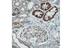 Immunohistochemical staining (Formalin-fixed paraffin-embedded sections) of human kidney with PGAM5 monoclonal antibody, clone CL0624  shows either strong or moderate cytoplasmic immunoreactivity in subsets of renal tubules.