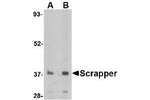 Image no. 1 for anti-F-Box and Leucine-Rich Repeat Protein 20 (FBXL20) (N-Term) antibody (ABIN1494347) (FBXL20 Antikörper  (N-Term))