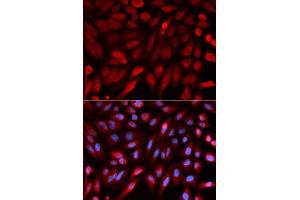 Immunofluorescence analysis of U2OS cells using SDCBP antibody. (SDCBP Antikörper)