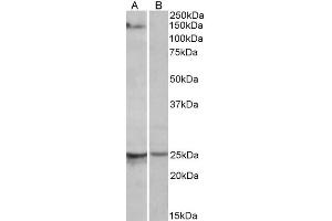 ABIN571262 (1µg/ml) staining of Mouse Heart lysate (35µg protein in RIPA buffer) with (B) and without (A) blocking with the immunising peptide.