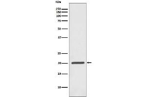 Western blot analysis of Ferritin expression in Jurkat cell lysate. (Rekombinanter Ferritin Antikörper)