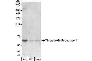 Western Blotting (WB) image for anti-Thioredoxin Reductase 1 (TXNRD1) (AA 125-175) antibody (ABIN7450817)