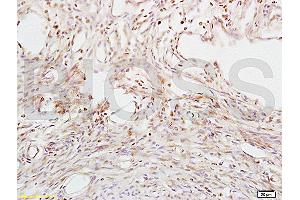 Formalin-fixed and paraffin embedded mouse uterus tissue labeled with Anti-ABP/SHBG Polyclonal Antibody, Unconjugated (ABIN739860) at 1:200 followed by conjugation to the secondary antibody and DAB staining (SHBG Antikörper  (AA 51-150))