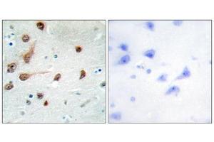 Immunohistochemistry (IHC) image for anti-Adenosine Deaminase, RNA-Specific (ADAR) (C-Term) antibody (ABIN1849470) (ADAR Antikörper  (C-Term))