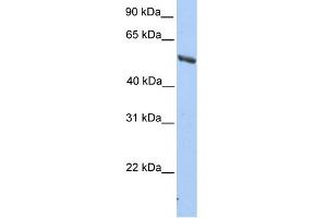 WB Suggested Anti-IMPDH2 Antibody Titration: 0. (IMPDH2 Antikörper  (C-Term))
