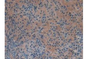 Immunohistochemistry (IHC) image for anti-serpin Peptidase Inhibitor, Clade A (Alpha-1 Antiproteinase, Antitrypsin), Member 6 (SERPINA6) (AA 268-391) antibody (ABIN7438403)