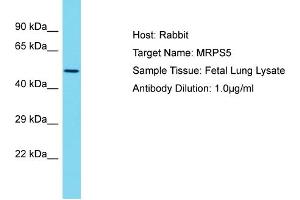 Host: Rabbit Target Name: MRPS5 Sample Type: Fetal Lung lysates Antibody Dilution: 1. (MRPS5 Antikörper  (N-Term))