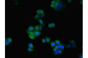 Immunofluorescent analysis of PC-3 cells using ABIN7170882 at dilution of 1:100 and Alexa Fluor 488-congugated AffiniPure Goat Anti-Rabbit IgG(H+L) (SDHA Antikörper  (AA 44-293))