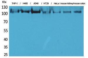 Western Blotting (WB) image for anti-Phospholipase A2, Group IVA (Cytosolic, Calcium-Dependent) (PLA2G4A) (N-Term) antibody (ABIN3187717) (PLA2G4A Antikörper  (N-Term))