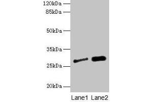 Western blot All lanes: IGFBP1 antibody at 3 μg/mL Lane 1: A549 whole cell lysate Lane 2: PC-3 whole cell lysate Secondary Goat polyclonal to rabbit IgG at 1/10000 dilution Predicted band size: 28 kDa Observed band size: 28 kDa (IGFBPI Antikörper  (AA 26-259))