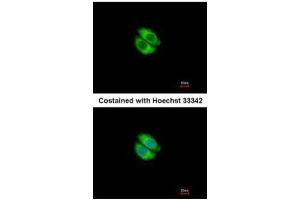 ICC/IF Image Immunofluorescence analysis of methanol-fixed A549, using Syntrophin alpha 1, antibody at 1:500 dilution. (SNTA1 Antikörper)