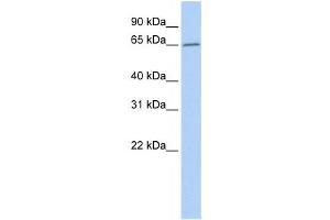 Western Blotting (WB) image for anti-Acyl-CoA Thioesterase 12 (ACOT12) antibody (ABIN2459539)
