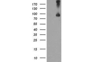 HEK293T cells were transfected with the pCMV6-ENTRY control (Left lane) or pCMV6-ENTRY TFR2 (Right lane) cDNA for 48 hrs and lysed. (Transferrin Receptor 2 Antikörper)