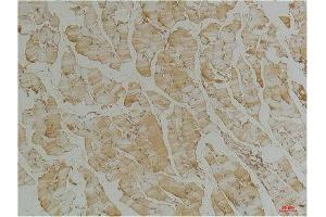 Immunohistochemistry (IHC) analysis of paraffin-embedded Mouse Skeletal Muscle Tissue using Desmin(Monoclonal Antibody diluted at 1:200.