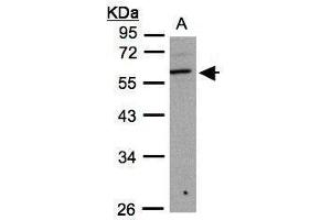 WB Image Sample(30 ug whole cell lysate) A:293T 10% SDS PAGE antibody diluted at 1:1000 (B3GNT3 Antikörper)