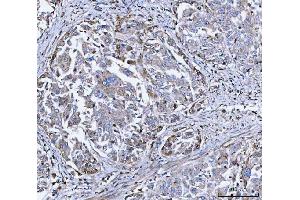 IHC analysis of DOCK180/DOCK1 using anti-DOCK180/DOCK1 antibody (ABIN7599615). (DOCK1 Antikörper  (AA 100-1732))